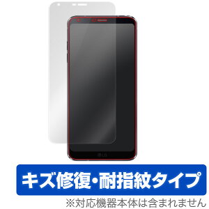 LG G6 �ی�t�B���� OverLay Magic for LG G6 �\�ʗp�ی�V�[�g�t�� �ی� �t�B���� �V�[�g �V�[�� �t�B���^�[ �L�Y�C�� �ώw�� �h�w�� �R�[�e�B���O �X�}�z�t�B���� �������� �~���r�b�N�X
