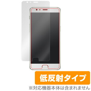 OnePlus 3T / OnePlus 3 یtB OverLay Plus for OnePlus 3T / OnePlus 3t ی tB V[g V[ tB^[ A`OA  ᔽ X}ztB  ~rbNX