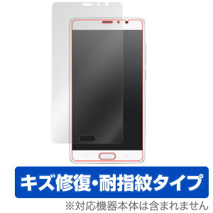 Xiaomi Redmi Pro �ی�t�B���� OverLay Magic for Xiaomi Redmi Pro�t�� �ی� �t�B���� �V�[�g �V�[�� �t�B���^�[ �L�Y�C�� �ώw�� �h�w�� �R�[�e�B���O �X�}�z�t�B���� �������� �~���r�b�N�X
