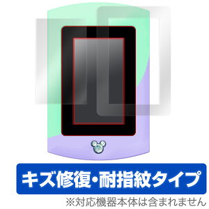 }WJpbh K[YbX یtB OverLay Magic for fBYj[LN^[Y }WJpbh K[YbXt ی tB V[g V[ tB^[ LYC ώw 