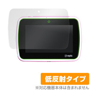 LeapFrog Epic �ی�t�B���� OverLay Plus for LeapFrog Epic�t�� �ی� �t�B���� �V�[�g �V�[�� �t�B���^�[ �A���`�O���A ����� �ᔽ�� �^�u���b�g �t�B���� �~���r�b�N�X