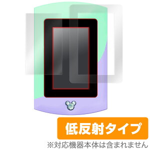 }WJpbh K[YbX یtB OverLay Plus for fBYj[LN^[Y }WJpbh K[YbX t ی tB V[g V[ tB^[ A`OA 