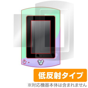 fBYj[LN^[Y یtB OverLay Plus for fBYj[LN^[Y }WJpbh K[YbX ({̕یV[gZbg)t ی tB^[ A`OA  