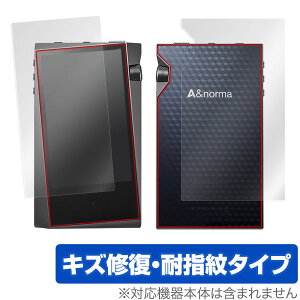 A&norma SR15 �ی�t�B���� OverLay Magic for A&norma SR15 �w�\�ʁE�w�ʃZ�b�g�x�t�� �ی� �t�B���� �V�[�g �V�[�� �t�B���^�[ �L�Y�C�� �ώw�� �h�w�� �R�[�e�B���O �~���r�b�N�X