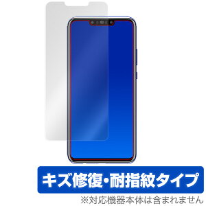 HUAWEI nova 3 �ی�t�B���� OverLay Magic for HUAWEI nova 3�t�� �ی� �t�B���� �V�[�g �V�[�� �t�B���^�[ �t�@�[�E�F�C �m�o3 �X�}�z�t�B���� �������� �~���r�b�N�X