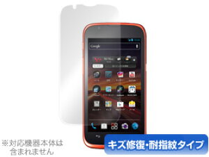 HUAWEI STREAM 201HW �ی�t�B���� OverLay Magic for HUAWEI STREAM 201HW �ی�t�B���� �ی�V�[�g �t���ی�t�B���� �t���ی�V�[�g �t���L�Y�C�� �ώw�� �h�w�� �R�[�e�B���O �X�}�z�t�B���� �������� �~