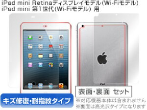 iPad mini 3 یtB OverLay Magic for iPad mini RetinafBXvCf/1(Wi-Fif) w\E(Brilliant)ʃZbgx یtB یV[@wʕیtB ^ubg tB ~