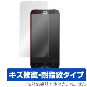 OverLay Magic for ASUS ZenFone 2(ZE551ML) ASUS�X�}�[�g�t�H�� Zenfone 2 �ی�t�B���� �ی�V�[�g �t���ی�t�B���� �t���ی�V�[�g �t���L�Y�C�� �ώw�� �h�w�� �R�[�e�B���O�@ZE551ML�@ZE550ML �X�}�z�t�B��