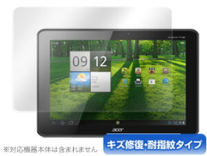 ICONIA TAB A700 �ی�t�B���� OverLay Magic for ICONIA TAB A700 �ی�t�B���� �ی�V�[�g �ی�V�[�� �t���ی�t�B���� �t���ی�V�[�g �t���ی�V�[�� �L�Y�C�� �ώw�� �h�w�� �R�[�e�B���O �^�u���b�g