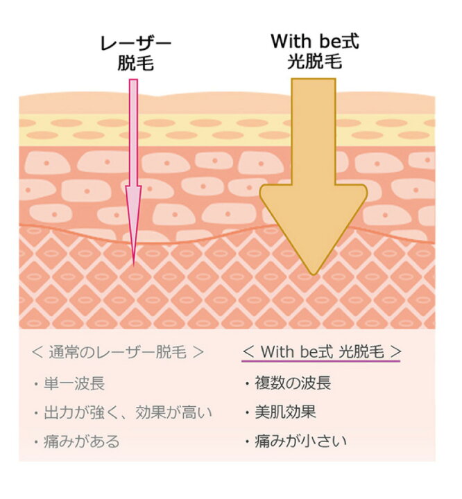楽天市場】(新商品) with be IPL光脱毛器 (ウィズビー 光脱毛器 ムダ毛 