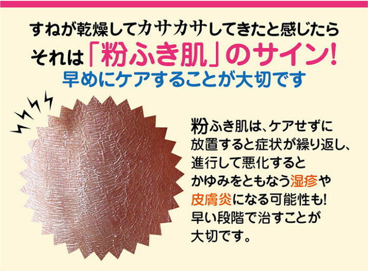 楽天市場 かさかさチェンジサポーター つやみ カサカサ 保湿 つるつる すべすべ 保湿ゲル 乾燥 履くだけ ヴィヴィアン マルシェ