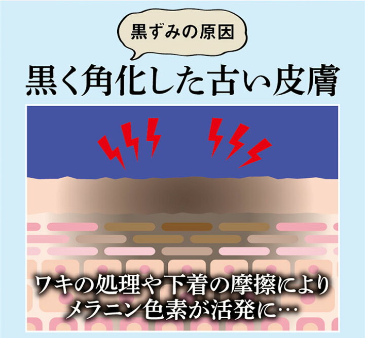 楽天市場 薬用 ピーリング ピーリングジェル 黒ずみ 黒ずみ対策 Vゾーン 脇 ワキ ザラザラ ジェル ツルツル デリケートゾーン専用 ナチュラル 日本製 ヴィヴィアン マルシェ