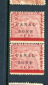 �J�i���]�[�� 11b �~���g �؎� 2���g�uINVERTED Bar Variety�v�iCZ11-b3�j