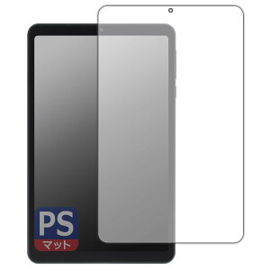 PDAH[ AvidPad A30 Ή PerfectShield ی tB [ʗp] ˒ጸ hw {