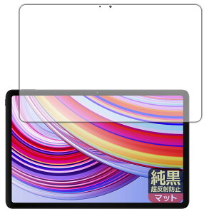 PDAH[ Xiaomi Redmi Pad Pro Ή NA[˖h~] ی tB [ʗp] ˒ጸ hw {