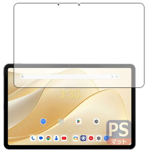 PDAH[ ALLDOCUBE iPlay 70 Pro Ή PerfectShield ی tB [ʗp] ˒ጸ hw {
