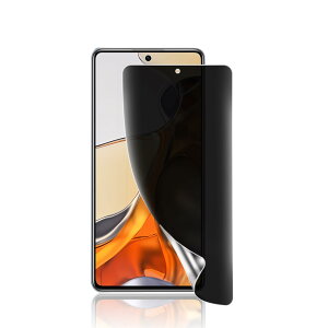 Ή Xiaomi 14T / 14T Prop `h~tB 炳 VI~ 14T/14T Pro TPUtیtB 24ԎCZp wFؑΉuCXg[c[tv14T / 14T Pro vCoV[ی V[