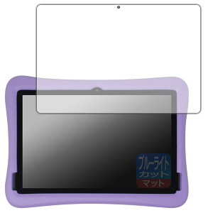 PDA�H�[ Plimpton PlimPad Kids 20 �Ή� �u���[���C�g�J�b�g[���˒ጸ] �ی� �t�B���� ���{��