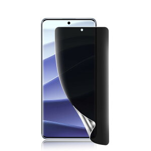 Redmi Note 14 Pro 5G �`�����h�~�t�B�����y�K�C�h�g�t���zTPU�f�� �����h�~/�C�A���X/�L�Y�C��/�����h�~//�P�[�X�Ɋ����Ȃ�/�S�ʕی� ���b�h�~�[ Note 14 Pro 5G �ی�t�B�����y�w��F�ؑΉ� 1����