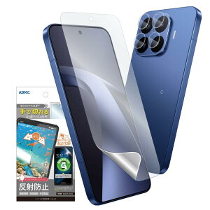ASDEC �A�X�f�b�N �t�B���� Xiaomi 17T Pro�p �A���`�O���A �J�����ی� ����Ȃ� ���炳�� ���{�� �}�b�g ���˖h�~ �w��h�~/NGB-MI17TP-Z