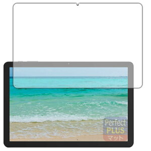 PDA�H�[ PHILIPS T7315 �Ή� PerfectShield Plus �ی� �t�B���� [��ʗp] ���˒ጸ �h�w�� ���{��