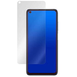 ~rbNX Xiaomi Redmi Note 9T 5G p ˖h~tیtB hw hCA { OverLay Plus OLXIAOMIREDMINOTE9T/12