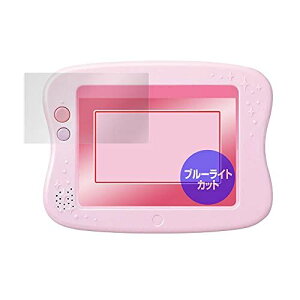 ~rbNX ڂɗD u[CgJbgی tB ^Cv }WJvC^C ł!Ђ낪 h[gCpbh vX / fBYj[LN^[Y p { OverLay Ey