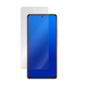 ~rbNX Xiaomi Redmi Note 10 Pro p ˖h~tیtB hw hCA { OverLay Plus OLREDMINOTE10PRO/F/12