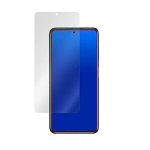 �~���r�b�N�X Xiaomi POCO X3 Pro �\�ʗp�ی�V�[�g �p ���˖h�~�t���ی�t�B���� �h�w�� �h�C�A ���{�� OverLay Plus OLPOCOX3PRO/F/12