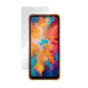 �~���r�b�N�X UMIDIGI BISON X10 �p ���˖h�~ �ی� �t�B���� �h�w�� �h�C�A ���{�� OverLay Plus