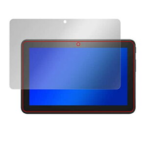 ~rbNX u[CgJbg  Fire 7 ^ubg (2022N / 12) p ڂɗD ی tB { OverLay Eye Protector
