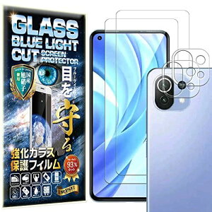 yu[CgJbg 93%z2{2 RISE KXtB J Y tB Xiaomi Mi 11 Lite 5G p یtB  KX   { Ɏq dx9H ...