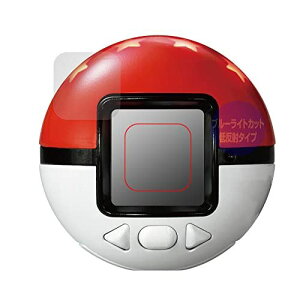 ~rbNX yʂ̂݁z |PbgX^[ |P ߂iQ! X^[{[ p u[CgJbg ᔽ ڂɗD ی tB { OverLay Plus Eye Protector