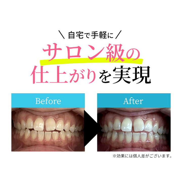 楽天市場】【10%OFF 4/17 9:59まで】 ＼累計55,000台突破 