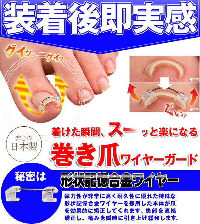 楽天市場 クーポン有 送料無料 巻き爪 ワイヤーガード 矯正 親指 足 巻きづめ 巻き爪ワイヤーガード 1ヶ月 ブロック テープ 矯正 巻爪 まきづめ まきつめ 補正 陥入爪 シール サポーター 巻きつめ 治療 改善 お悩み ツメ 巻づめ 痛み 緩和 痛み 軽減 メール便