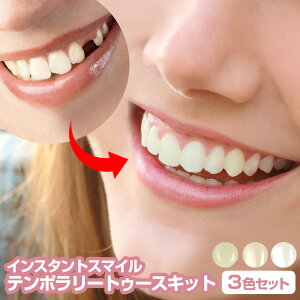 CX^gX}Ce|[gD[XLbg CX^gX}C e|[gD[X eB[X p t tO Ή Lbg 3F R i` uCg _[