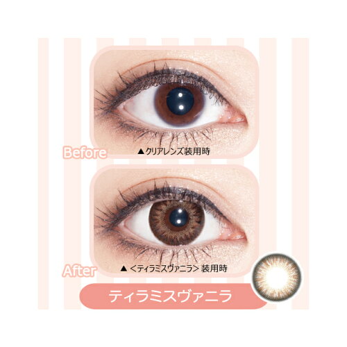 コンタクト