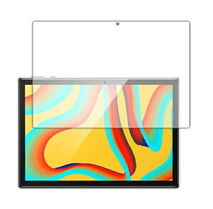 MARVUE Pad M20 یtB MARVUE M20 KXtB tB MARVUE 10.1inch^ubgP[X ی KX KX 9H