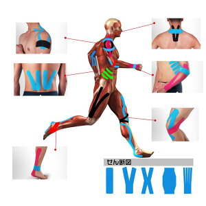 e[sOe[v LlVI e[v ؓE֐߂T|[g Lk ɋ ptH[}X߂ 5cm×5m 1