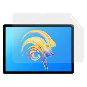 JP�t�B������吻�����t ALLDOCUBE X Game 10.5�C���` �p �t�B���� [�u���[���C�g�J�b�g�E���˖h�~�E�A���`�O���A] �w��h�~ �R�� �C�A���X �����z�� �^�u���b�g�t���ی�t�B����