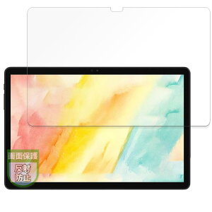 MotoMoto �t�B���� ALLDOCUBE iPlay 60S (���) �p �ی�t�B���� ���˒ጸ �w��h�~ ���{��