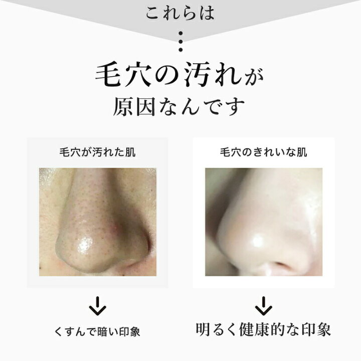 楽天市場 洗顔フォーム 泡 洗顔料 毛穴の黒ずみ 泥洗顔 クレイ洗顔料 吸着 毛穴 毛穴ケア 無添加 100g 敏感肌 乾燥肌 洗顔 メンズ レディース オーガニック しっとり コラーゲン ヒアルロン酸 保湿 日本 Natural Clay Wash 泡立てネット 付き 美容健康専門店 Wow Medical