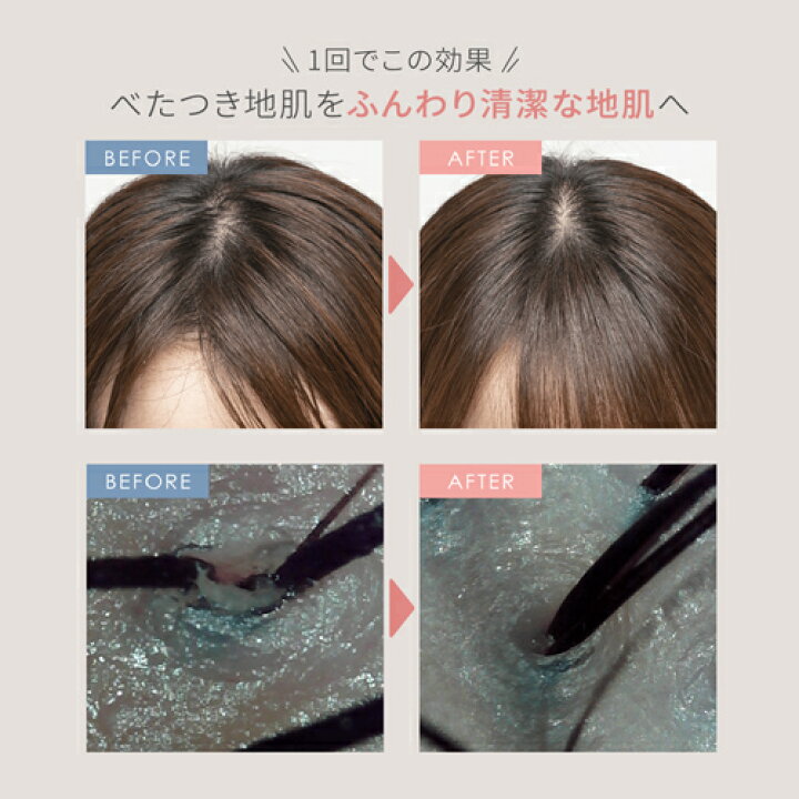 楽天市場】ヘッドスパ 電動頭皮ブラシ 【ヤーマン公式】《ミーゼ 