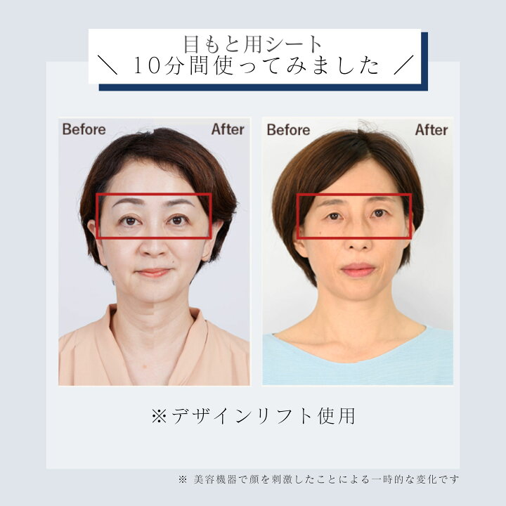 楽天市場】☆新発売☆目もと 口もと 美顔器 ウェアラブル ハンズフリー 