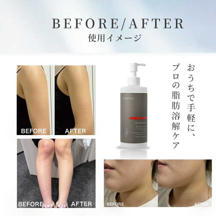 楽天市場】ドットセルエッセンス 300ml セルライトケア 脂肪分解 代謝 