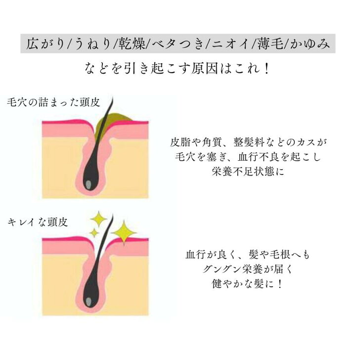 Orelia®︎【公式】ヘアブラシオレリアスカルプケアブラシくしブラシスカルプ防水ツヤ髪ヘアケア美髪頭皮ケア艶髪シャンプーブラシトリートメントブラシインバスブローパサつき抜け毛髪の匂いダメージ毛育毛さらさらつやギフトプレゼント母の日