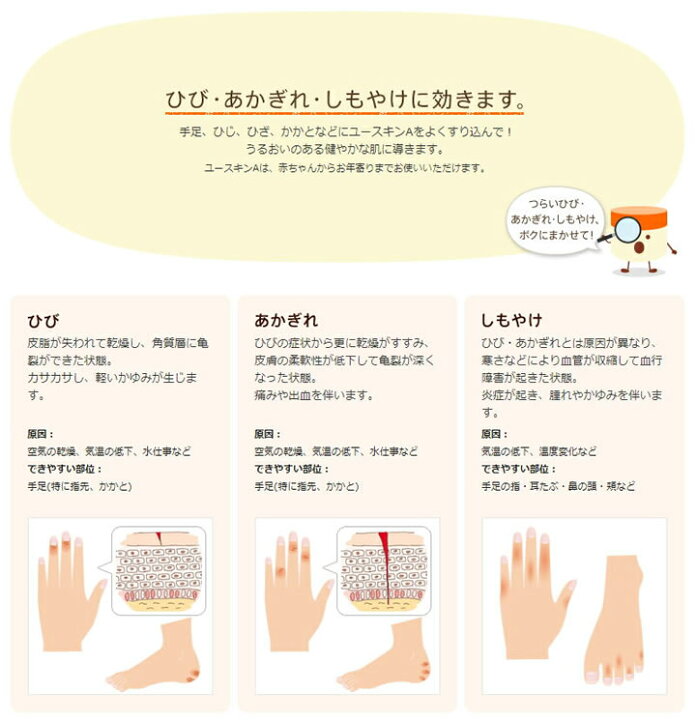 楽天市場 ユースキン製薬 ユースキンa 60g ケンコウlife