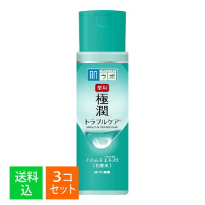 y×3 z܂z[g  ɏ pXLRfBVi[ 170mL