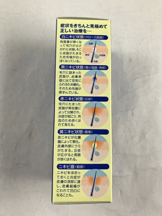 303円 熱販売 メンターム アクネローション 110mL 1個 第2類医薬品 303円 熱販売 メンターム アクネローション 110mL 1個 第2類医薬品