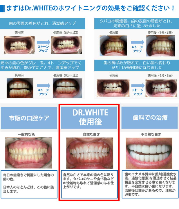 楽天市場】ホワイトニング 歯ホワイトニング 自宅簡単 LED ドクター 